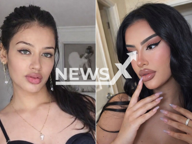 Picture shows Brazilian influencer Julia Medeiros, 24, in a before and after photo. She said she had to renew her passport three times after undergoing a series of cosmetic procedures. Note: Photo obtained with permission. (@juju.brazil/CO ASSESSORIA/Newsflash)