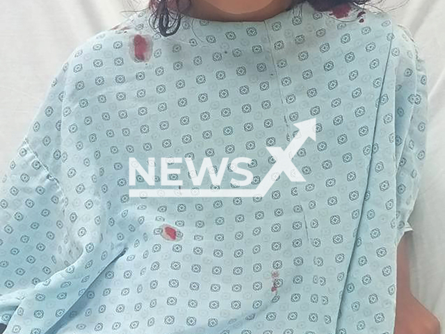 Picture shows seven-year-old Grecy, undated. Pilo, the dog that attacked her, will be put down in Frontera, Coahuila in Mexico. Note: Private photo. (Newsflash)