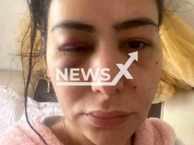 Fide Uyarlar (pictured) was allegedly attacked by Gokhan Kizilyer on several occasions in Adana, Turkey. Note: Private picture (Newsflash)