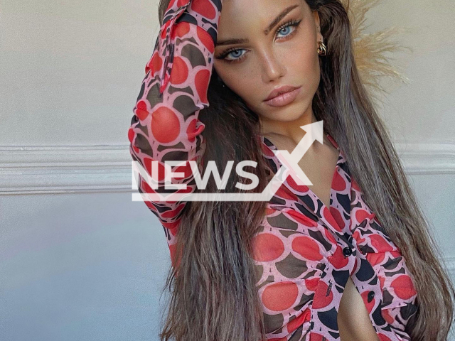 Turkish influencer Beren Guney (pictured), formerly known as Tolga Imanoglu, after she had sex reassignment surgery and a series of aesthetic operations. Note: Private picture (@berennguney/Newsflash)