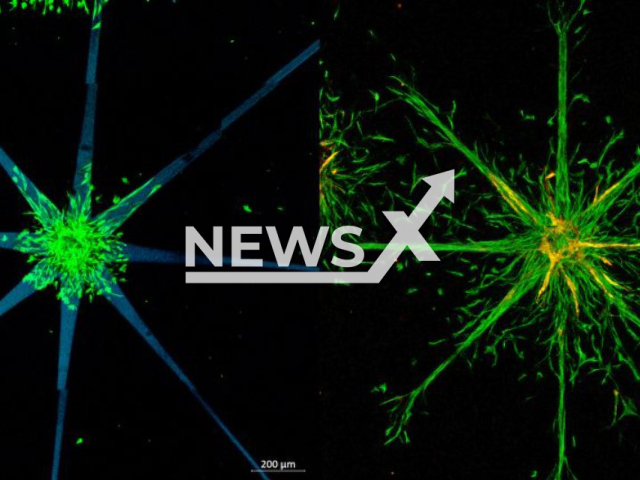 Star shaped patters are created (left), into which the cells can grow (right).
Note: Licensed photo(Technische Universitat Wien/Newsflash).