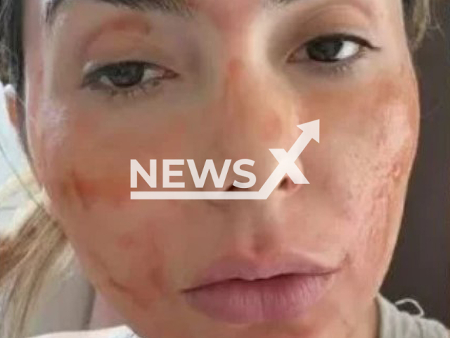 Model Mimi Boliviana who uses her own menstrual blood to take care of her skin. Note: Private photo(Mimi Boliviana/Newsflash).