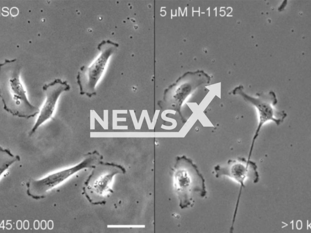 University of Minnesota Twin Cities engineers have discovered that cancer cells invade the body based on their environment. The discovery provides new understanding of how cancer spreads and can improve future treatments.
Note: Licensed photo(David Odde Laboratory, University of Minnesota/Newsflash).