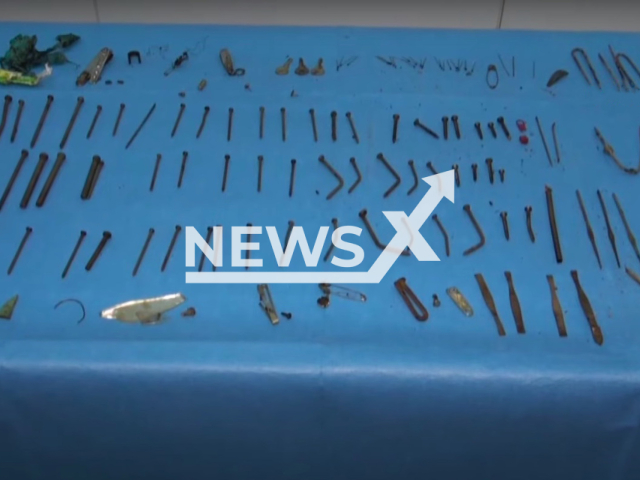 More than one hundred metal foreign bodies were removed from the stomach of a 25-year-old female patient in Van, Turkey. Note: Picture is a screenshot from a video (Newsflash)