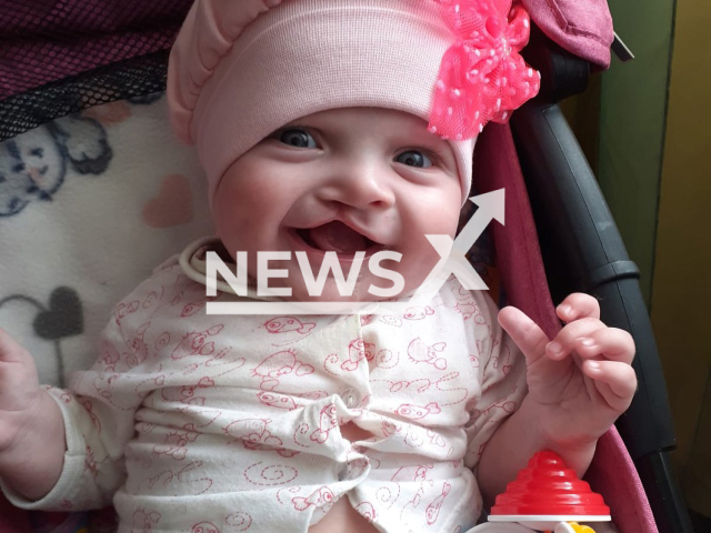 Angelina Bavrina, a six-month-old baby girl, died after lip surgery in Novosibirsk, Russi, on 15th May 2022. Note: Picture is private (Svetlana Anatolyevna/Newsflash)