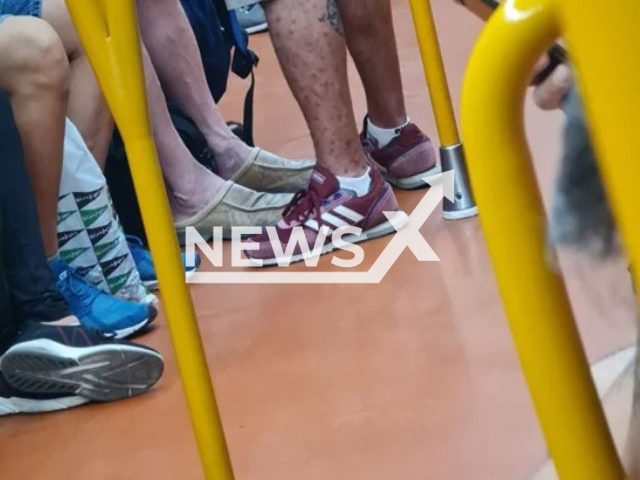 A man with monkeypox on the subway in Madrid, Spain, on  July 15, 2022. He was spotted by a doctor. Note: Private photo.  (@arturohenriques/Newsflash)