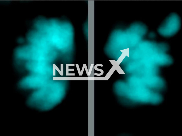 Visualization of fewer chromosome segregation errors in modern human in contrast to Neanderthal neural stem cells in an undated photo. German researchers discovered differences in the development of Neanderthal and modern human brains, as of Friday, July 29, 2022. Note: Licensed photo. (Felipe Mora-Bermudez, MPI-CBG/Newsflash)