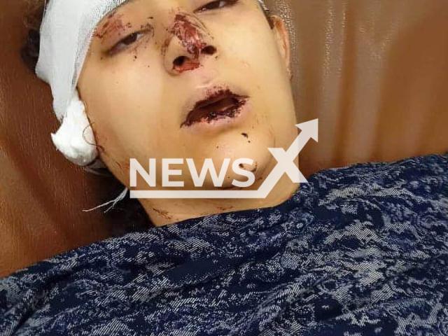 Picture shows the Egyptian woman Raneen after her husband chopped off her ear and stabbed her 20 times over a household expenditure dispute in Helwan city, Egypt, in an undated photo. Raneen forgave him after she recovered. Note: Private photo. (Newsflash)