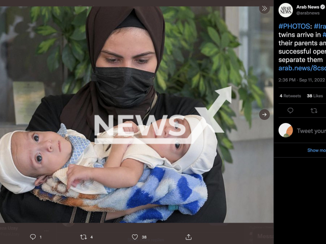 Iraqi conjoined twins arrived in Riyadh, Saudi Arabia, on Sunday, Sept. 11, 2022, for medical evaluation amid hopes for a successful operation to separate them. The pair, Omar and Ali, landed with their parents at King Khalid International Airport from Iraq and were immediately transferred to King Abdullah Specialized Children’s Hospital. Note: Picture is a screenshot from a post (Newsflash)