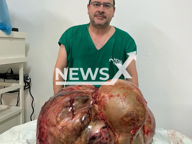 General surgeon Glaucio Boechat, poses with the  46 kilogram tumour, in Itaperuna, Brazil, undated. It was removed from a woman  that arrived at the hospital in a serious condition, on Wednesday, Aug. 31, 2022. Note: Private photo.  (@drglaucioboechat/Newsflash)