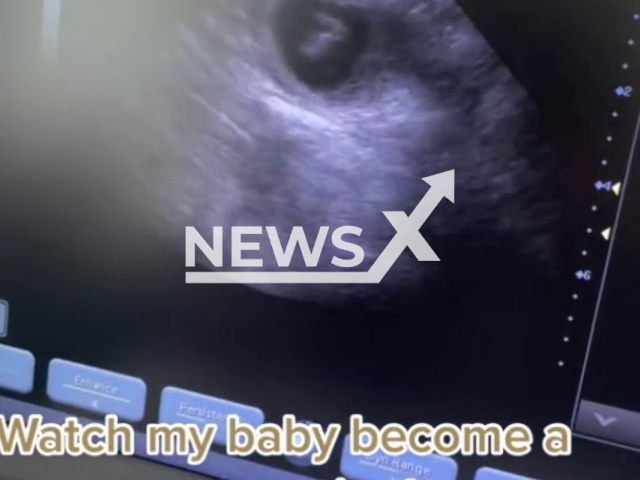 Picture shows the baby pup's ultrasound scan, undated footage. Rosie, a Lhasa Apso, gave birth to a single puppy, Milo, and the pair became besties. Note: Photo is a screenshot from the video (@paigesayles_/Newsflash)