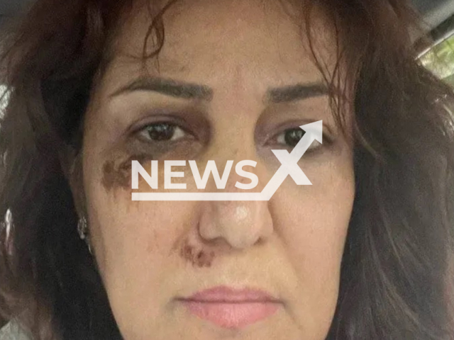 Pantea Bahram poses in an undated photo. Bahram, an Iranian actress, posted a photo of her showing the bruises on her face after the security forces summoned her. Note: Picture is private (@officialpanteabahram/Newsflash)