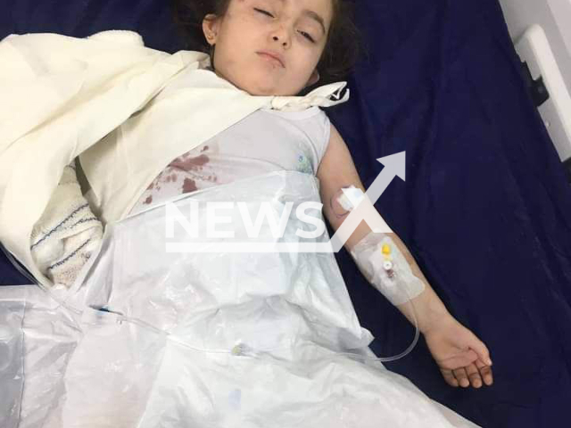 A girl lies on a hospital bed in Sulaymaniyah, Iraq, in an undated photo.  She was reportedly attacked by a bear in a zoo. Note: Picture is private (Newsflash)