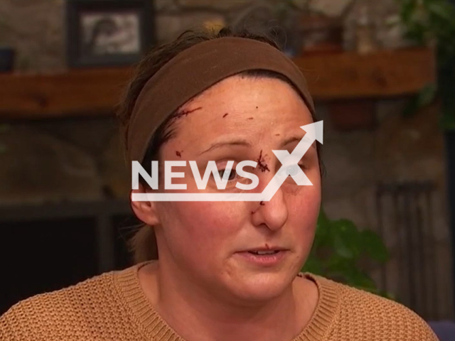 Picture shows Sarah Dietl, 43, undated.  She was mauled by a bear in Winhall, Vermont after she let her Shih Tzu out of the house on  Wednesday, Nov. 2, 2022. Note: Photo is a screenshot from a video. (Newsflash)