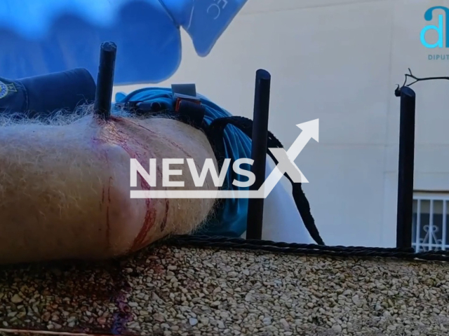 The injury of a 71-year-old man pierced by an iron bar from a fence, in Torrevieja, Spain, on Sunday, Nov. 6, 2022. He was bleeding profusely  and was given medical care. Note: Picture is a screenshot from a video. (@bomberosalicantecpba/Newsflash)