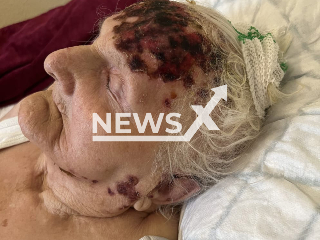 Image shows victim Waltraud B., 93, undated photo. She died after a nurse forgot a drying hood on her head in a nursing home in the town of Schwedt/Oder in Brandenburg, in northeastern Germany on Aug. 14, 2022. Note: Private photo. (Newsflash)