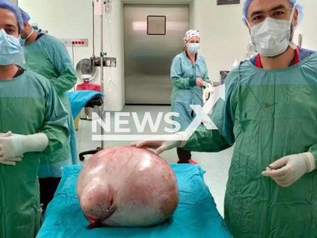 Doctors pose with a mass taken out from the abdomen of a patient in Tekirdag, Turkey, undated photo. The mass reportedly weighed about 35 kilogrammes. Note: Picture is private (Newsflash)