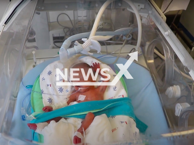 A baby boy, named Yavuz Selim Cihan, (pictured) who was prematurely born when he was 23 weeks old in Tekirdag, Turkey, holds on to life thanks to the mesenchymal stem cell treatment he received for his lung development. Note: Picture is a screenshot from a video (Newsflash)