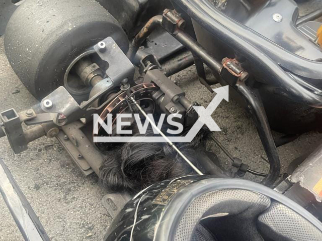 Picture shows the   hair that became tangled in the  go-kart during a race in Durban, South Africa, undated. Kristen 15, has spent a week in ICU with spinal bruising, spinal cord damage and a torn aorta after the accident on Wednesday, Dec. 28, 2022.

Note: Private photo.  (Vernon Govender/Newsflash)