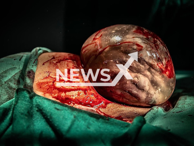 Photo shows a baby named Nicolas born in Muriae, in the Zona da Mata of Minas Gerais, Brazil, Monday, Jan. 2, 2023. He was born surrounded by the amniotic sack. Note: We have obtained permission for the photo from Ludmila Gusman (@ludmilagusmanfotografias/Newsflash)