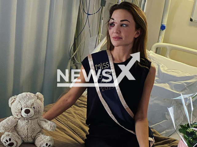 Miss Belgium Chayenne Van Aarle  in the hospital after the accident poses in undated photo.  Her car hit a truck on the highway in Kruibeke, Belgium, on Tuesday, Feb. 07, 2023.
Note: Private photo. (@chayennevanaarle/Newsflash)