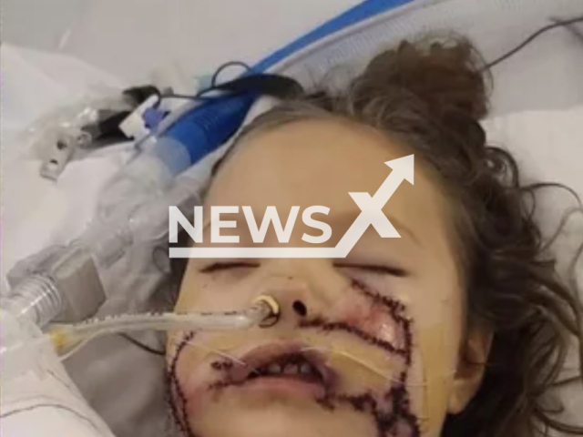 Photo shows Lily Norton, 6, undated. She reportedly received over 1000 stitches after being attacked by a dog in Chesterville, Maine, USA. Note: Picture is private (GoFundMe/Newsflash)