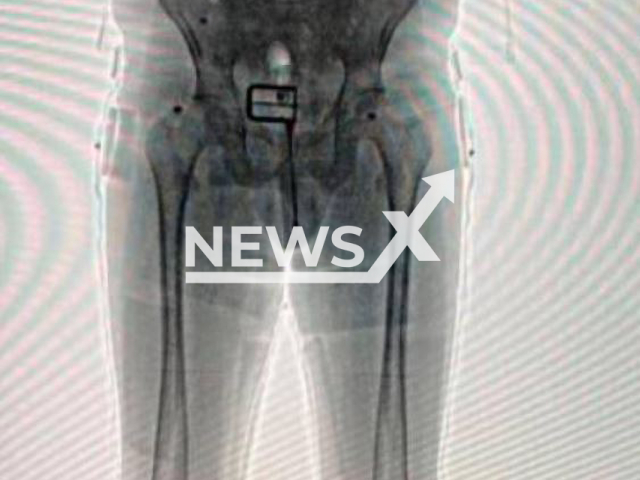 Picture shows the body scan, undated. A man was found to have 50 and 100 dollar bills hidden among his boxers, tied with a lycra at the airport in Bogota, Colombia, in March, 2023. Note: Private photo.  (Newsflash)