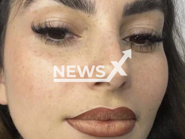 Image shows Yeliz Koc, aged 29, during the lip pigmentation surgery, undated photo. The woman from the city of Hanover, in Lower Saxony, Germany, underwent the procedure in March 2023. Note: Private photo. (@_yelizkoc_/Newsflash)