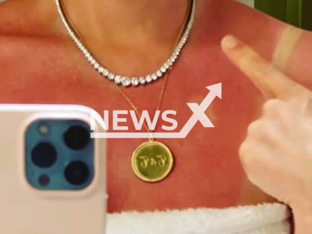 Thalia, 50, burned her skin while tanning. Note: Picture is a screenshot from a video (@thalia/Newsflash)