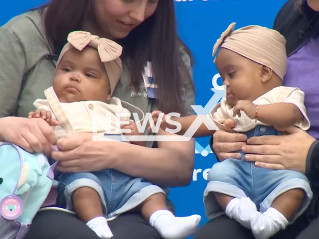 Picture shows AmieLynn Rose and JamieLynn Rae Finley after they were separated in  Fort Worth, Texas, USA, undated. They were   conjoined at the chest and shared a liver and were separated in an 11-hour surgery by a team of 25. 
 
 Note: Photo is a screenshot from a video. (Newsflash)