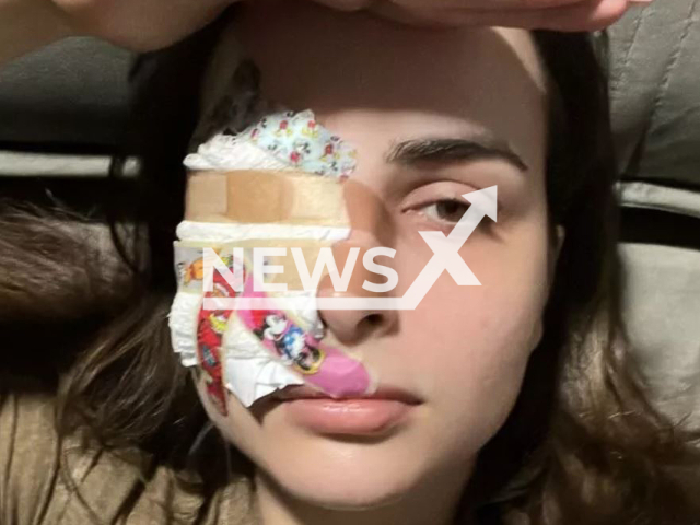 Jessica Cardoso, influencer, had an accident at her home and tore off a piece of her cornea while scratching her eyes with long nails, in Brasilia, Brazil, in March, 2022.
Note: Private photo.  (Newsflash)