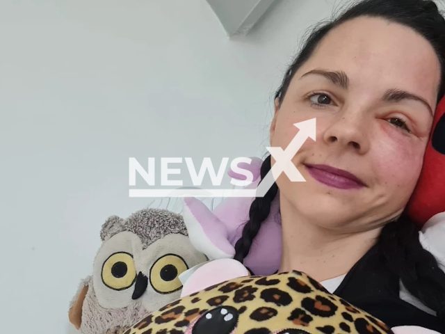 Jessica Leidolph, 37, poses in undated photo. She underwent a third operation to save her eye at the Halle University Hospital, in Saxony-Anhalt State, Germany. Note: Private photo. (Newsflash)