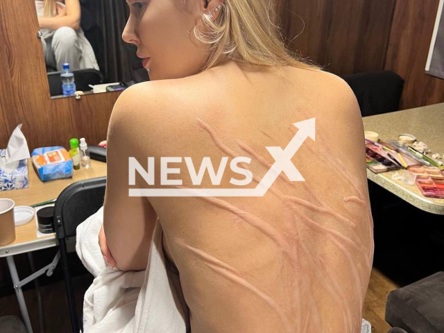 Picture shows Russian actress and influencer Natalia Rudova, 39, undated. She shocked her fans with a frightening photo of scars on her back, which turned out to be makeup for the movie. Note: Private photo. (@rudovanata/Newsflash)