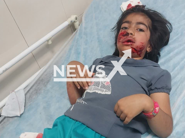 Photo shows a six-year-old girl who was attacked by a dog in Birjand, Iran. Two more children and a woman were reportedly attacked by a dog in Birjand, Iran. Note: Picture is private (Newsflash)