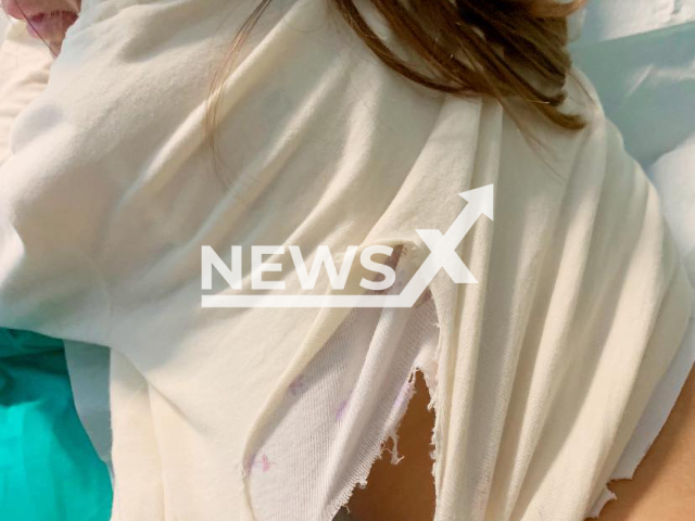 Picture shows the ripped shirt  of the 4-year-old girl, undated.  A wild dog, possibly a wolf, attacked two children on the beach of Vasto Marina in Abruzzo, , Italy, on Sunday, May 7, 2023.
 Note: Private photo.  (@giampaolo.natale.5/Newsflash)