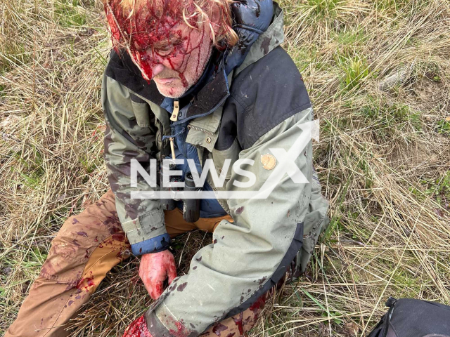 Image shows Andreas Kieling, 63, after he was attacked by a bear, undated photo. It reportedly happened in the Carpathian Mountains, Central Europe. Note: Private photo. (@Andreas.Kieling/Newsflash)